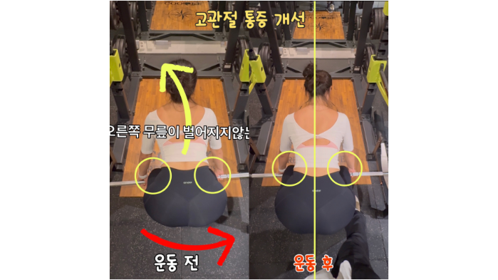 고관절 개선