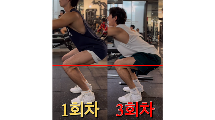 무릎 연골 재활