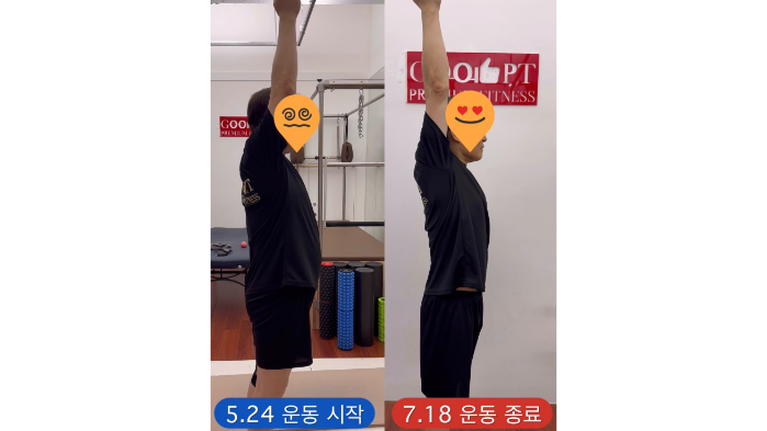 운동 전후 2