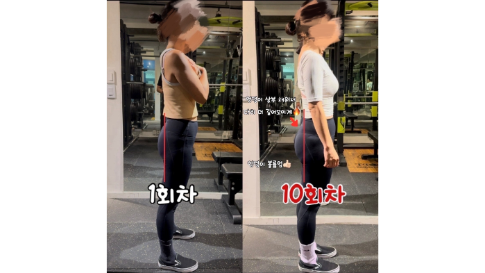 힙업 개선